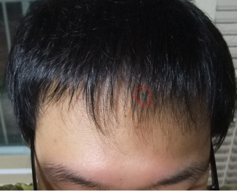 1.png