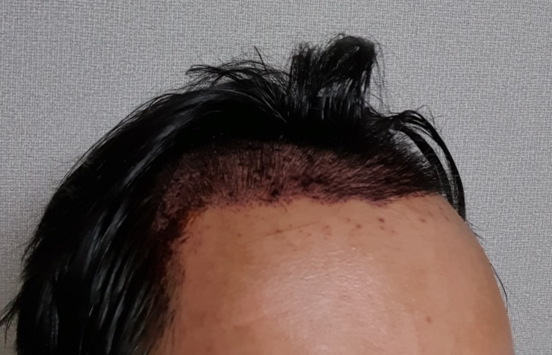 수술후1.jpg