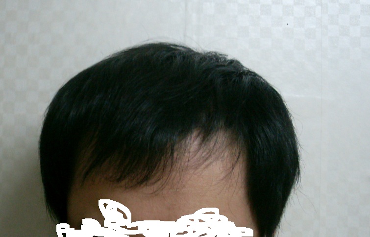전.jpg