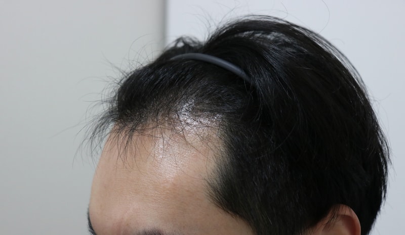 수술전2.jpg