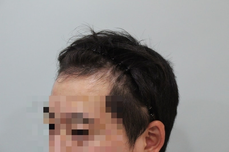 수술전 (7).JPG
