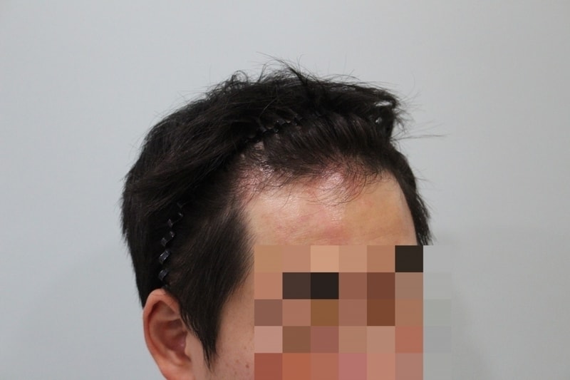 수술전 (1).JPG