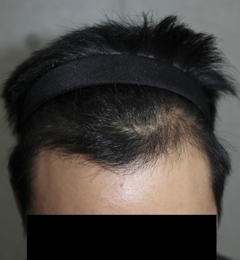 수술후01.png