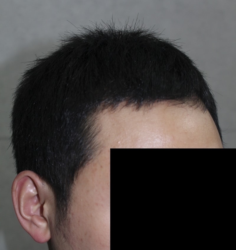 수술후04.png