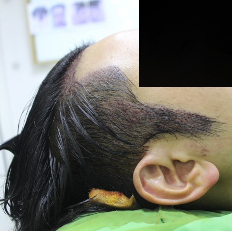 수술직후2.png