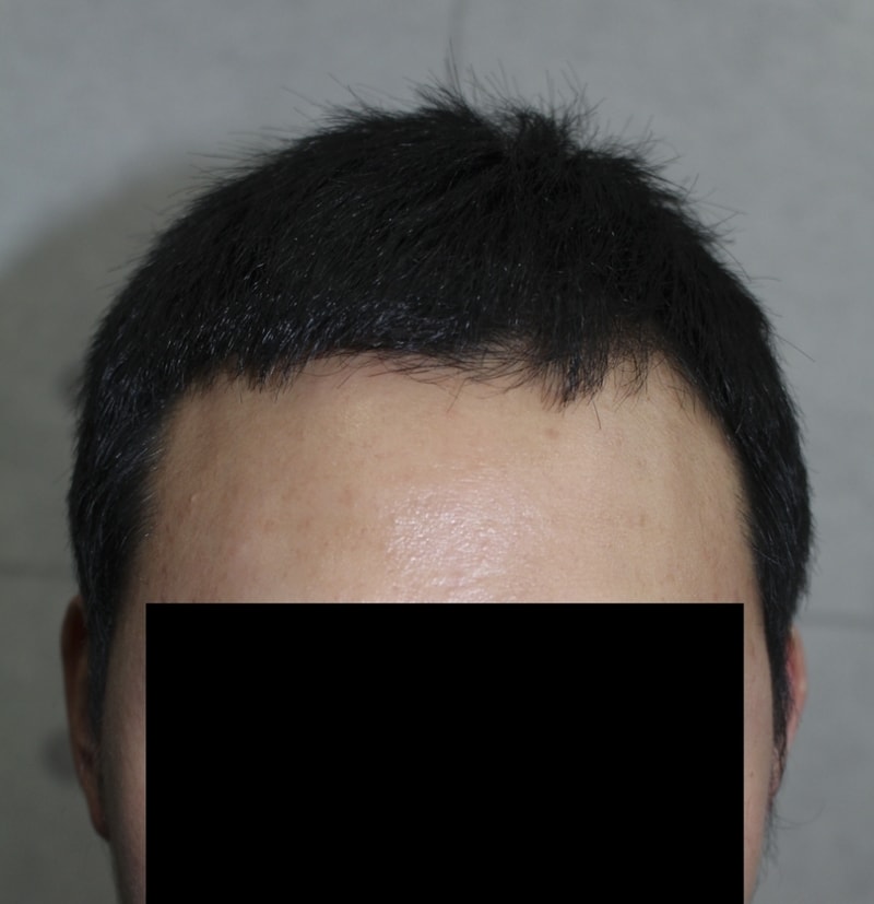 수술후03.png