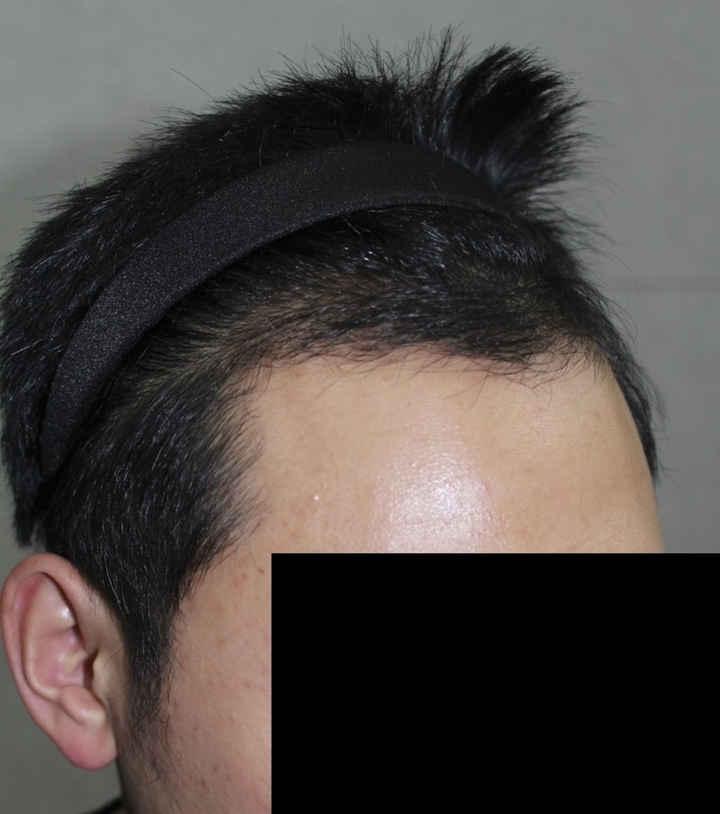 수술후02.png
