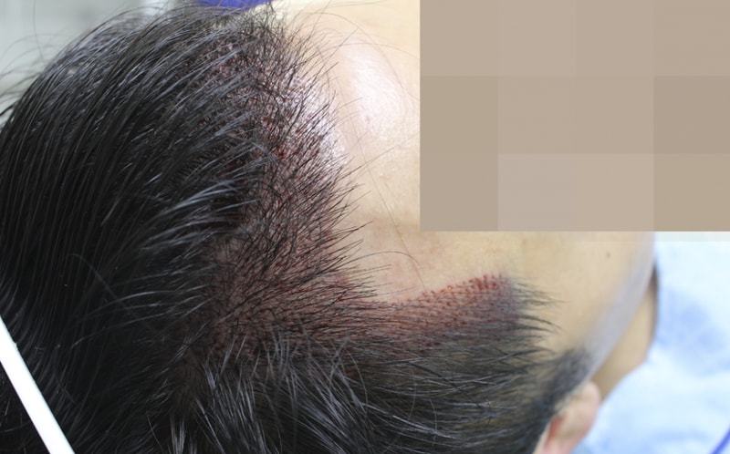 김 동윤_20130927_모발_126934.png
