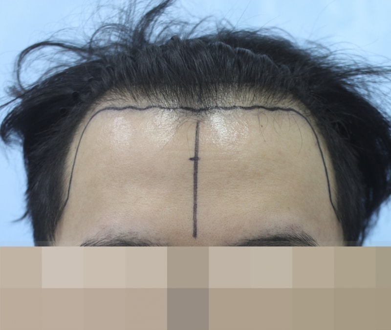 김 동윤_20130926_모발_126921.png