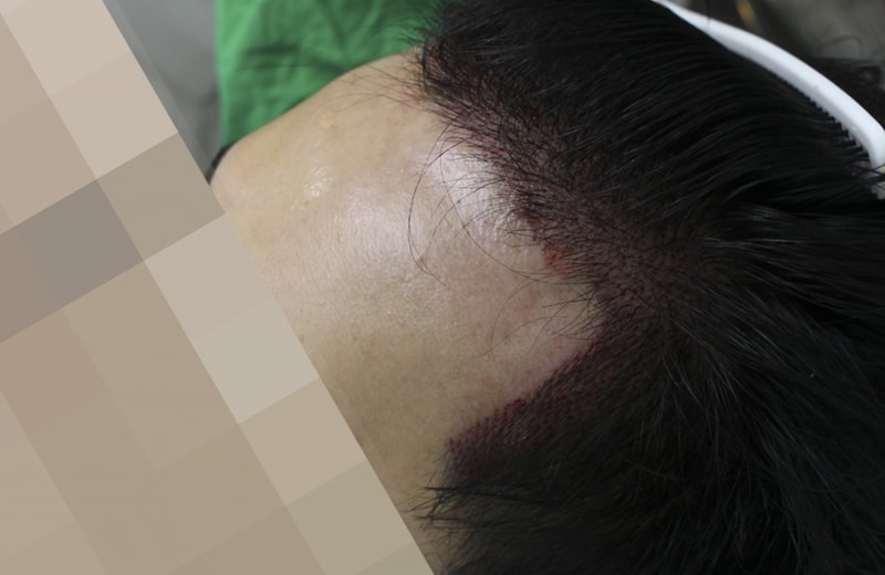 김 동윤_20130927_모발_126933.png