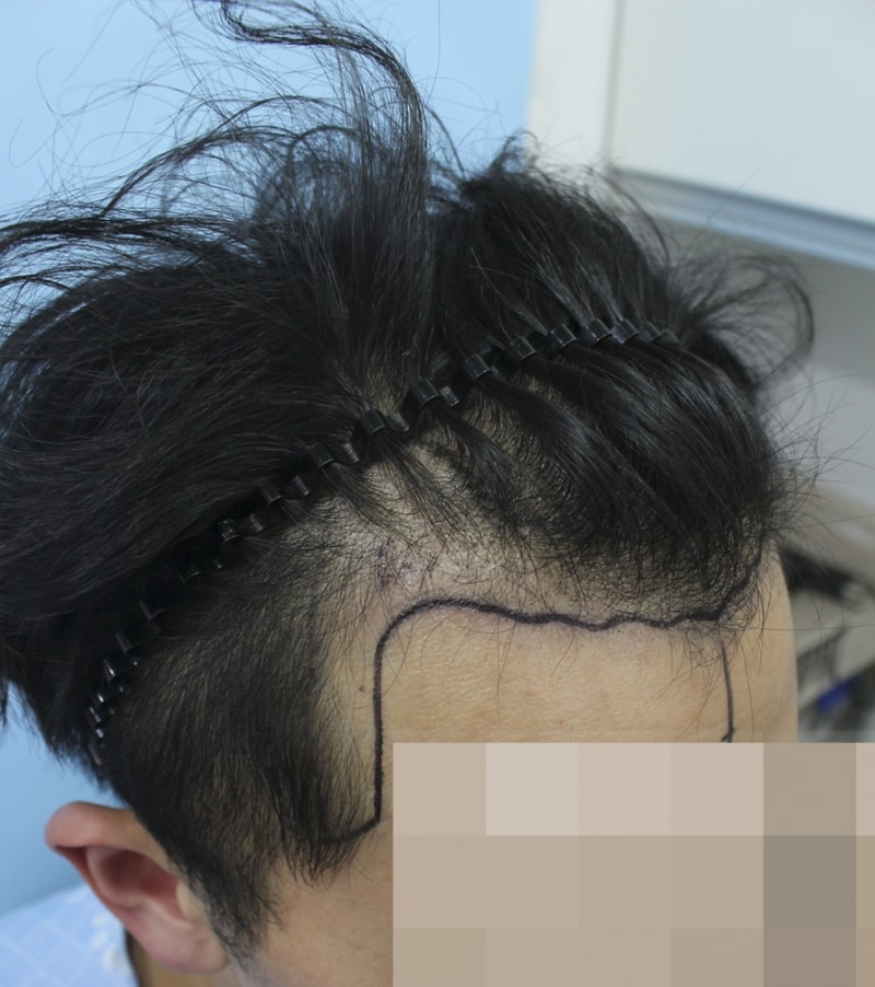김 동윤_20130926_모발_126927.png