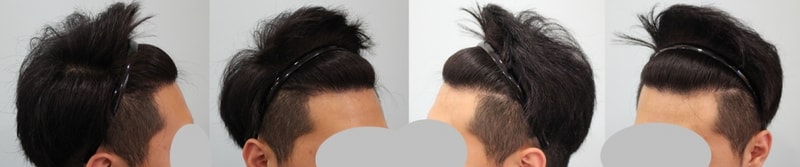 수술후3.jpg