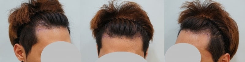 수술전.jpg