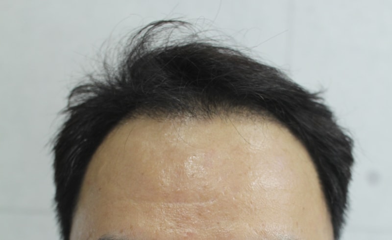 3개월인데 이 정도면 대박인 것 같습니다