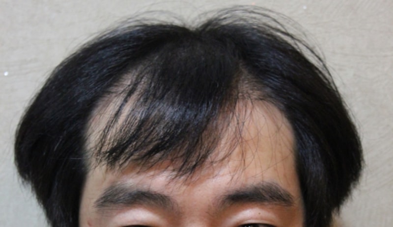 1.JPG
