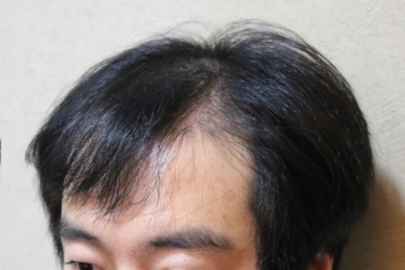 3.JPG