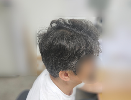 옆통수.jpg