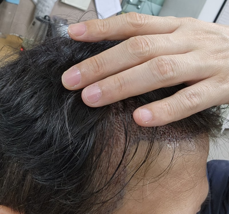 직후3.jpg