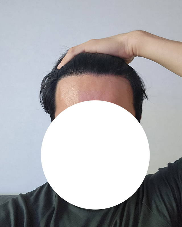 25개월.jpg