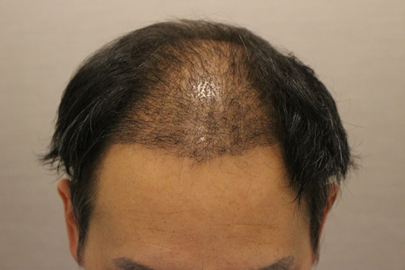 수술후 10일 (1).JPG