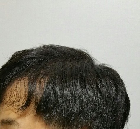 KakaoTalk_20200309_163909642.jpg