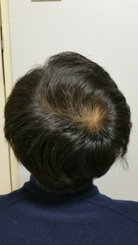 KakaoTalk_20200309_163850390.jpg