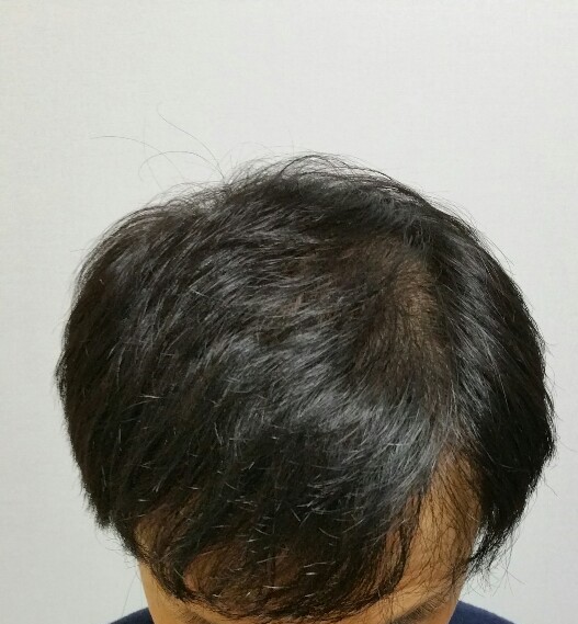 KakaoTalk_20200309_163906658.jpg