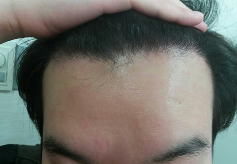 허재훈7개월1.jpg
