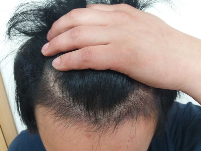 3개월 후.jpg