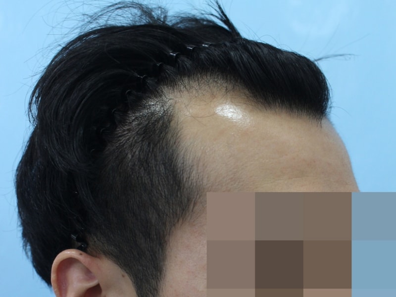 수술전 (2).jpg