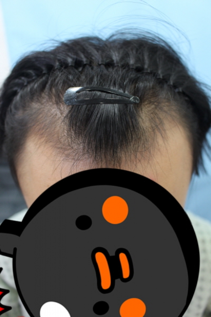 아직 조금 먹먹하네요