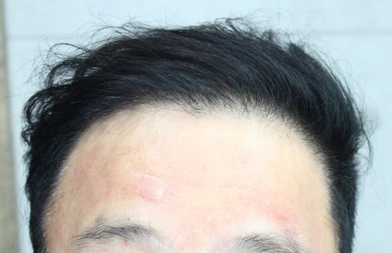 4개월 (7).JPG