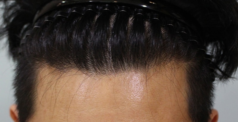 수술전 (2).JPG
