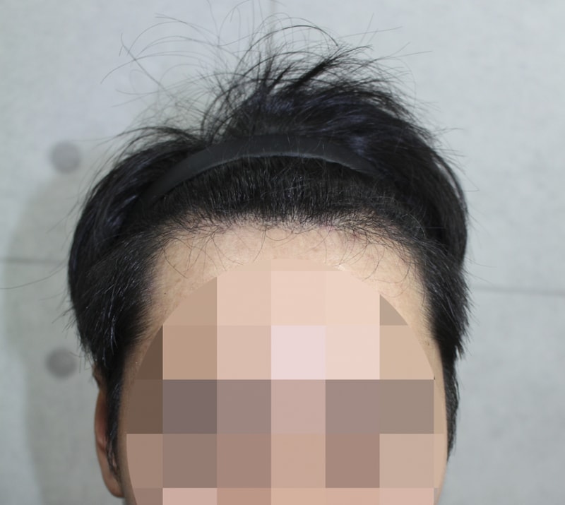 IMG_4209_9개월.png