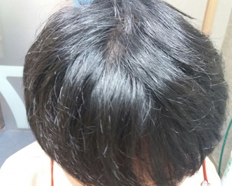 후4.jpg