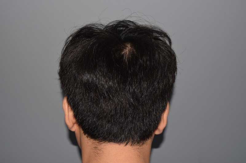뒤통수내림.JPG