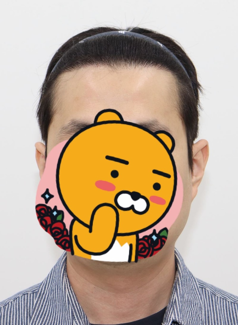 자연스러움의 끝. 압구정 포헤어 M자 비절개모발이식 7개월 후기 (정대건 원장님)