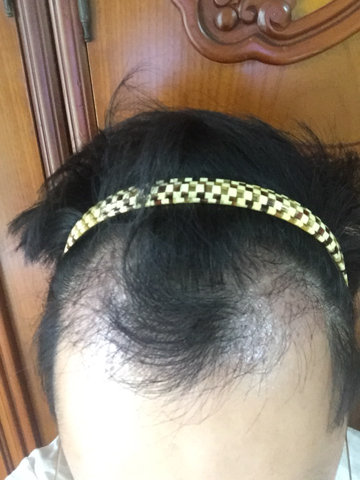 KakaoTalk_20180722_174755555.jpg