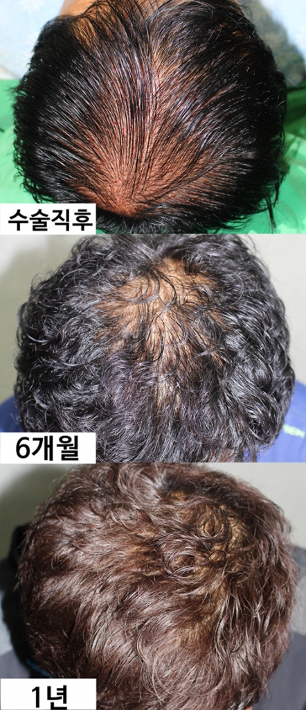 제목 없음-1.png