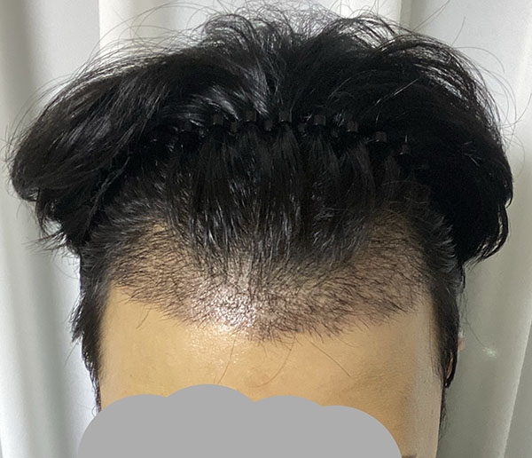 19일.jpg