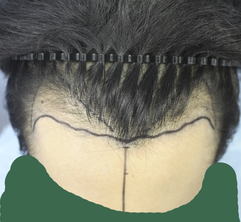 001.jpg