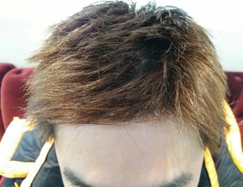 후3.jpg