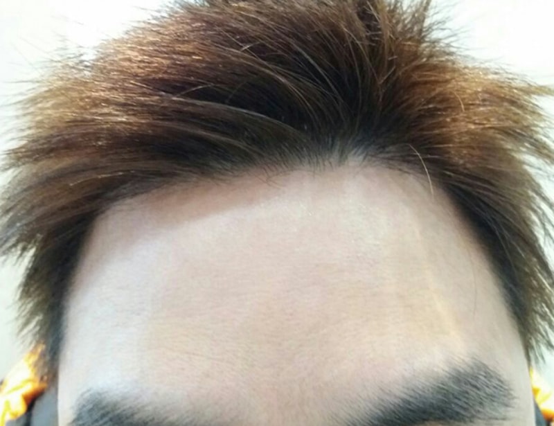 후2.jpg