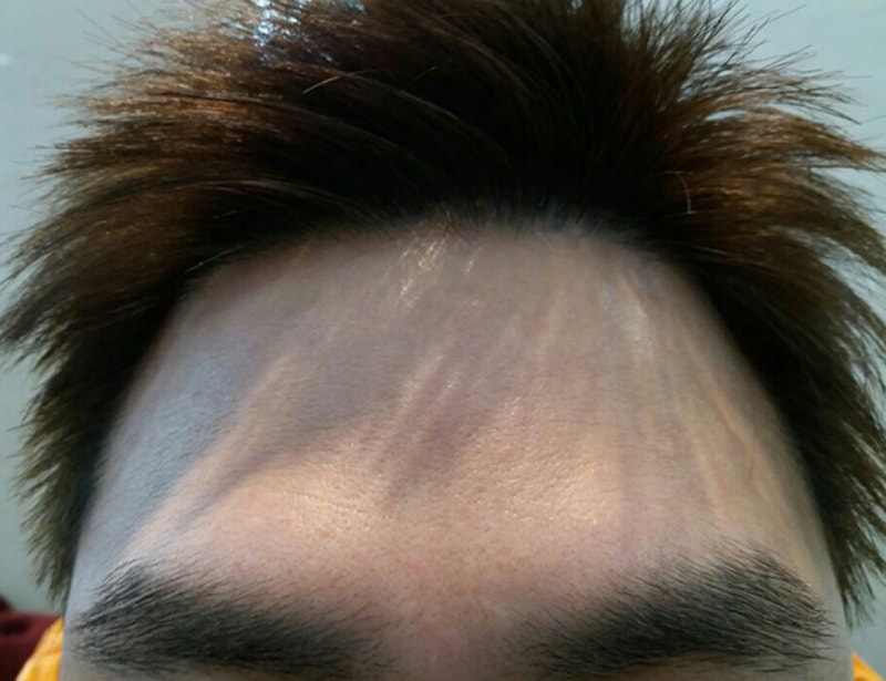 후1.jpg
