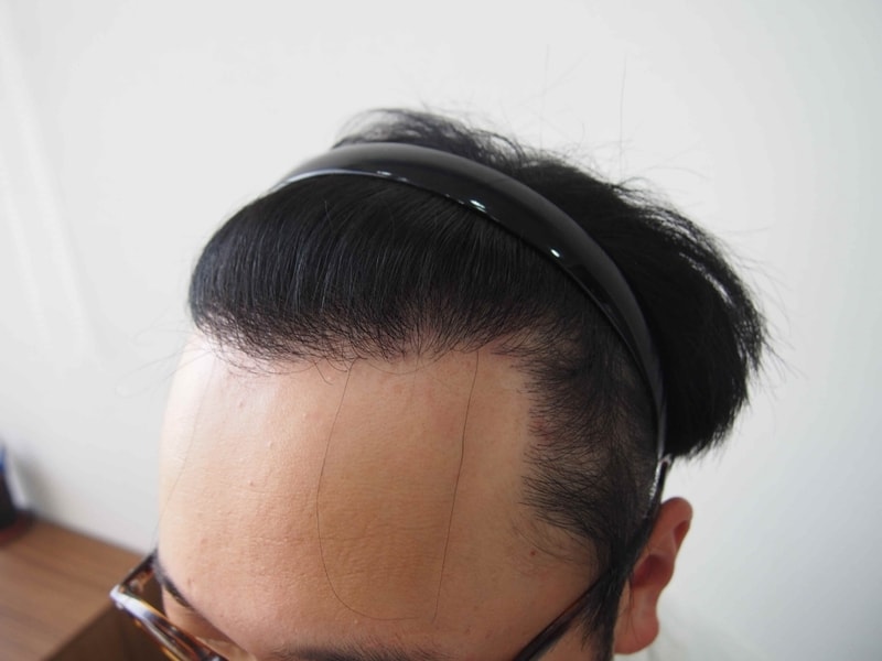 크기변환_10개월 머리 올리고 2.JPG