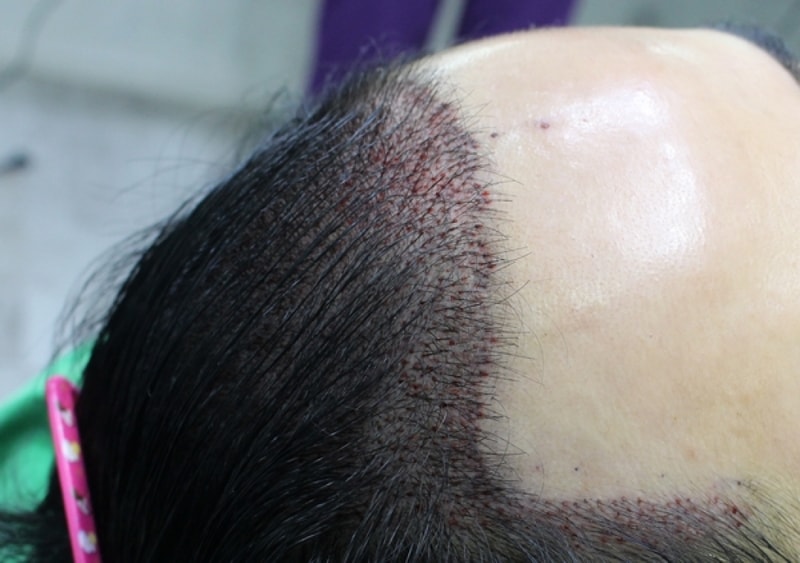안 형준_20160830_모발_44609.jpg
