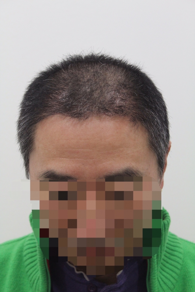 KakaoTalk_20160425_175136522.jpg