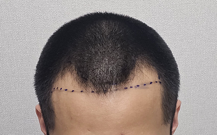 3.디자인후.jpg