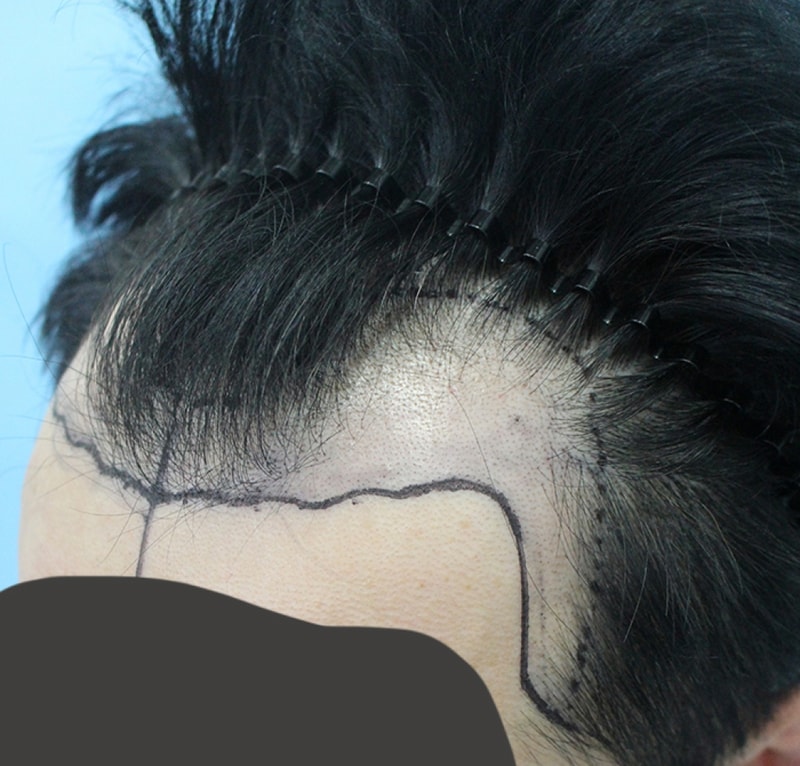김 희승_20160316_모발_15185.jpg