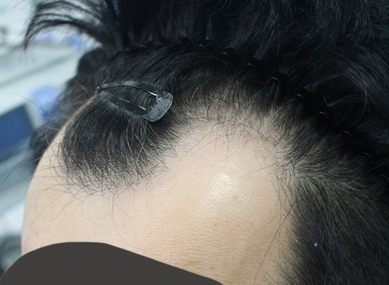 김 희승_20160316_모발_15175.jpg